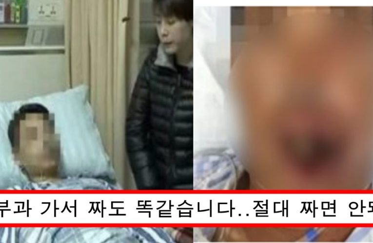 “여드름 절대 짜지 마세요”요즘 한국에서 여드름 짰다가 사망,피부괴사하는 사건 엄청나게 발생중